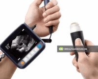 WristScan V9 Veterinary Ultrasound for Sale at Alpha Agventure Farms